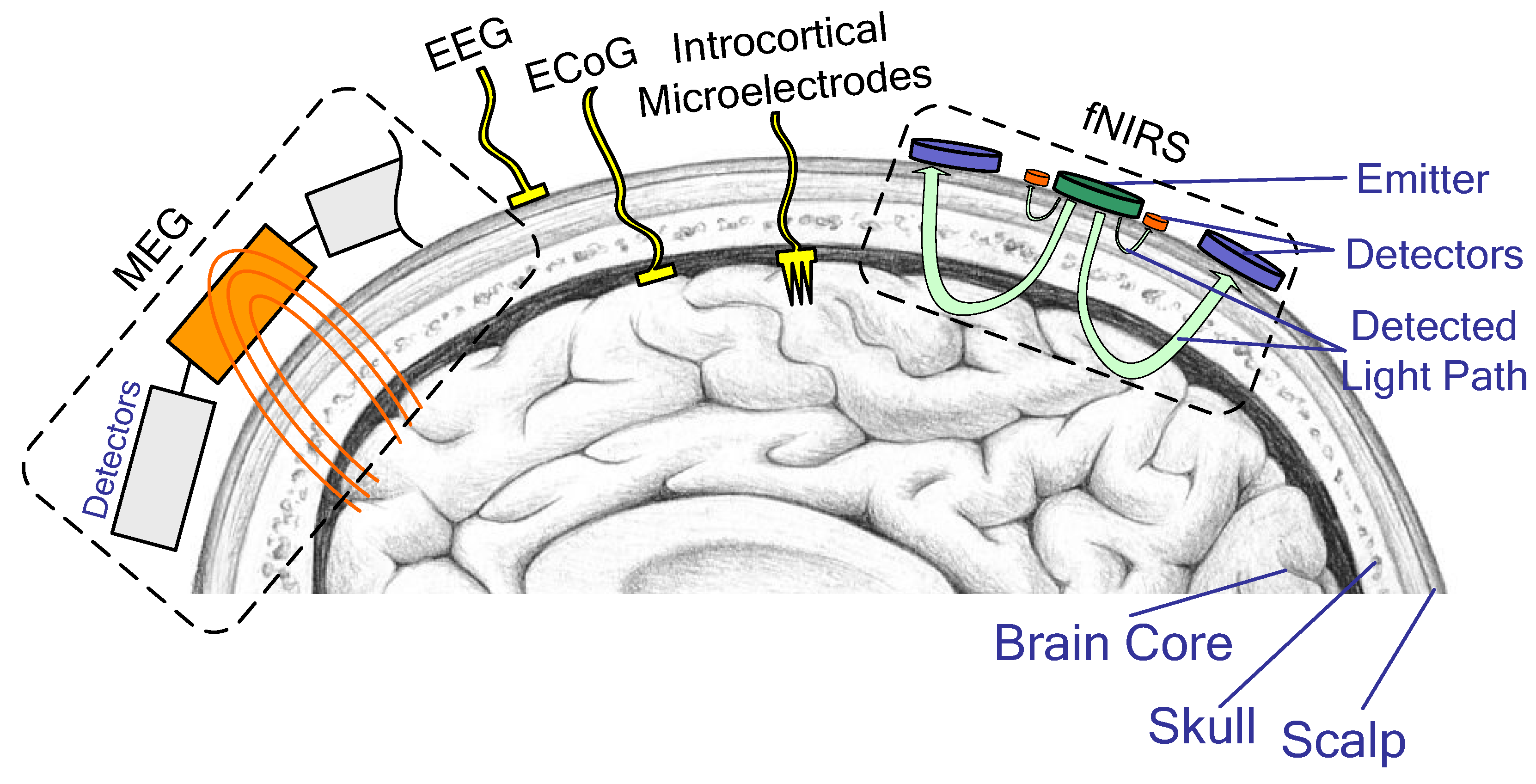 Comparison of brain-computer interface sensor placements: penetrating electrodes in cortex, an electrode sheet on the cortical surface, and external sensors outside the skull.