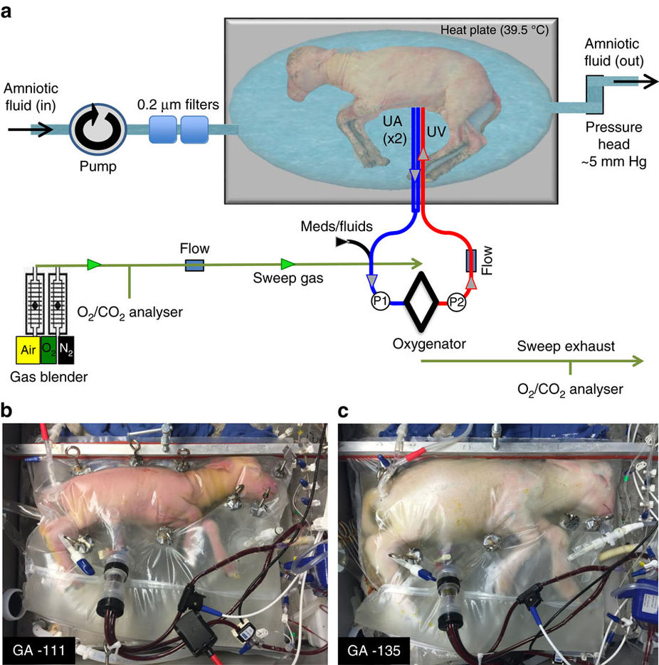 Three-panel figure: a schematic of a lamb floating in a fluid-filled bag connected through umbilical cannulas to a pumpless oxygenator circuit, above two photographs of premature lambs inside sealed transparent bags of fluid.