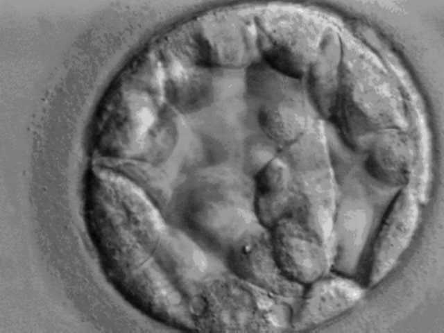 Grey-scale micrograph of a day-5 human blastocyst: a hollow sphere of cells with an inner cell mass visible to one side, surrounded by the zona pellucida.