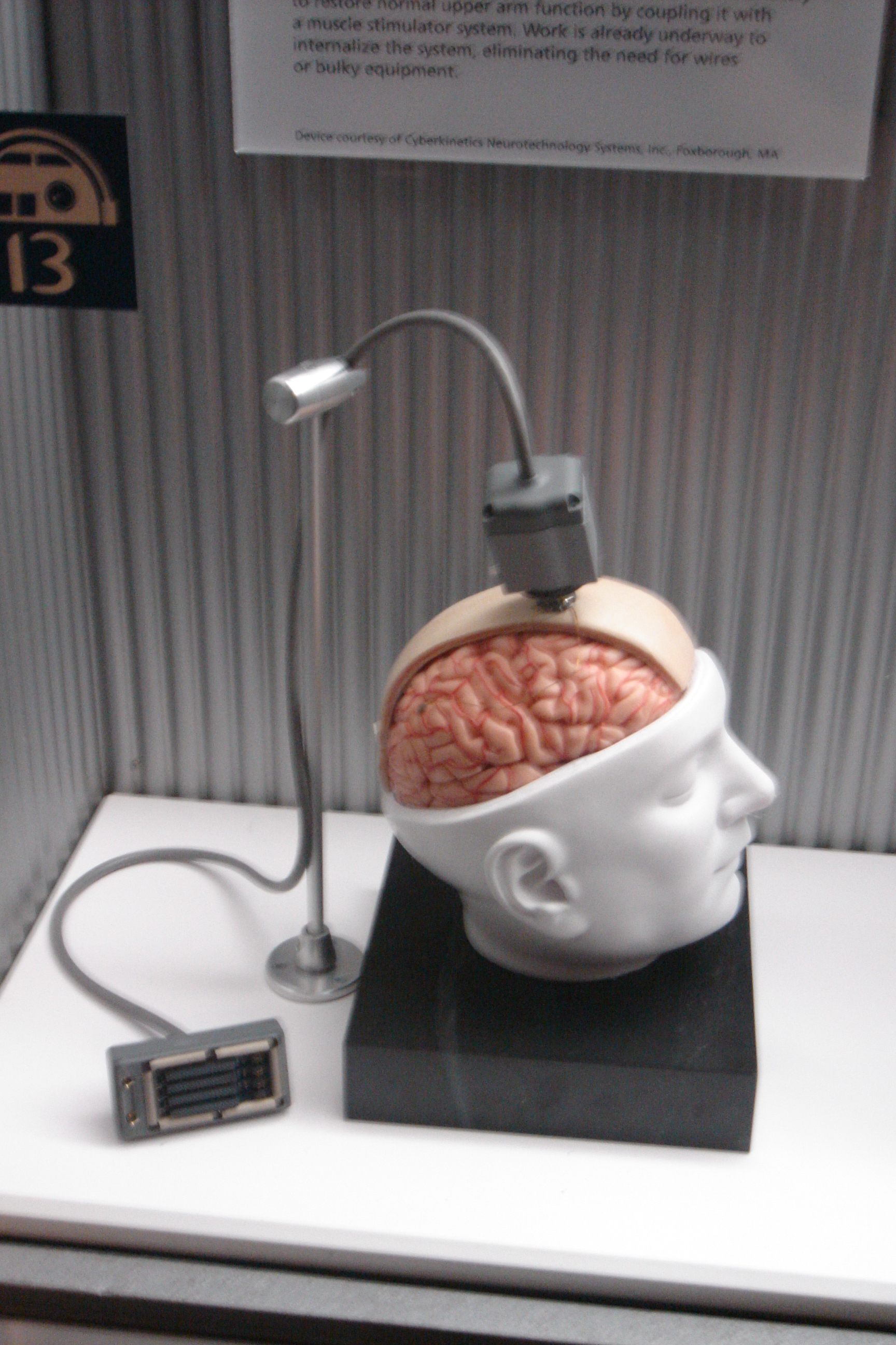 The BrainGate implanted electrode array held between finger and thumb, showing its scale against a human hand.