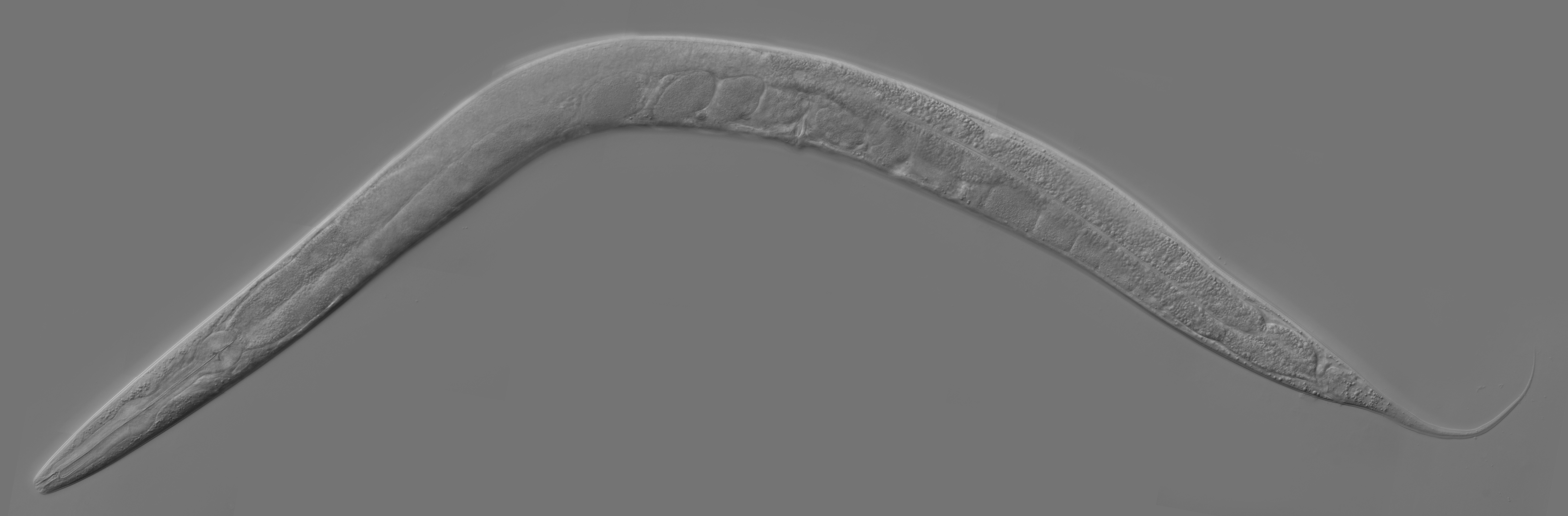 Micrograph of an adult Caenorhabditis elegans nematode, a transparent worm about a millimetre long, with internal structures visible through the cuticle.