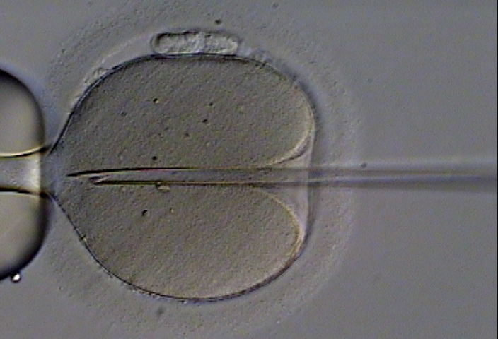 Micrograph of a human oocyte held by a suction pipette on the left while a fine glass needle penetrates the cell from the right, its tip deep inside the cytoplasm.