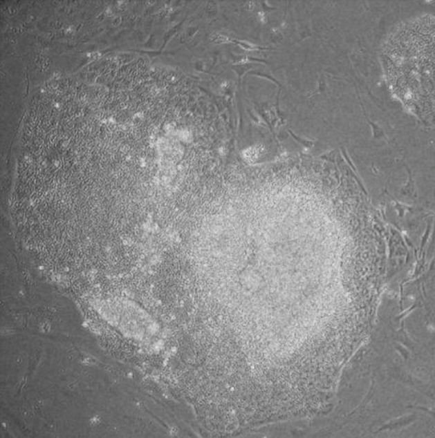 Phase-contrast micrograph of human induced pluripotent stem cell colonies growing in culture as dense, sharply bordered clusters.