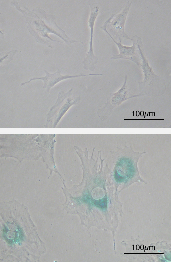 Two phase-contrast micrographs of mouse embryonic fibroblasts: spindle-shaped cells at an early passage above, and enlarged, flattened cells stained blue-green for senescence-associated beta-galactosidase below.